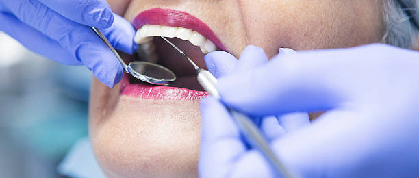 Best Emergency Dental Care for Broken or Chipped Teeth in Warsaw, NC