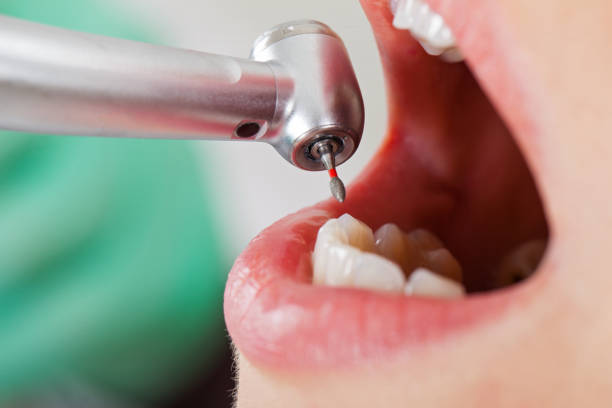 Best Emergency Denture Repair in Warsaw, NC